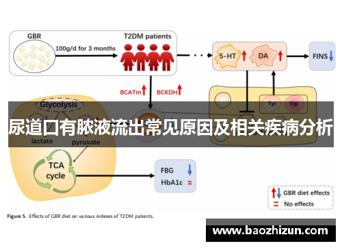 尿道口有脓液流出常见原因及相关疾病分析